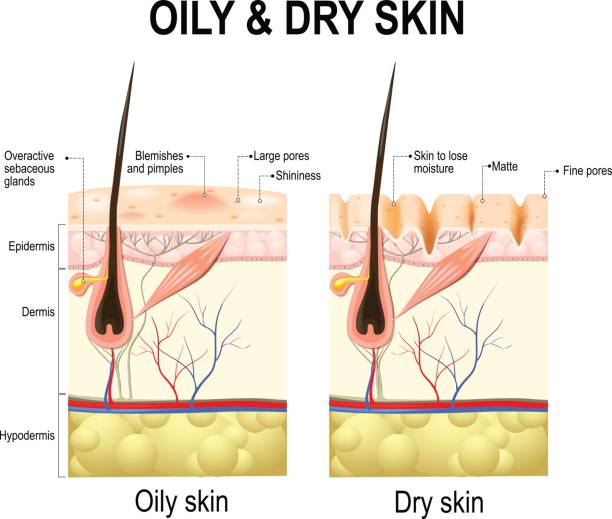 масляная и сухая кожа - melanocyte stock illustrations