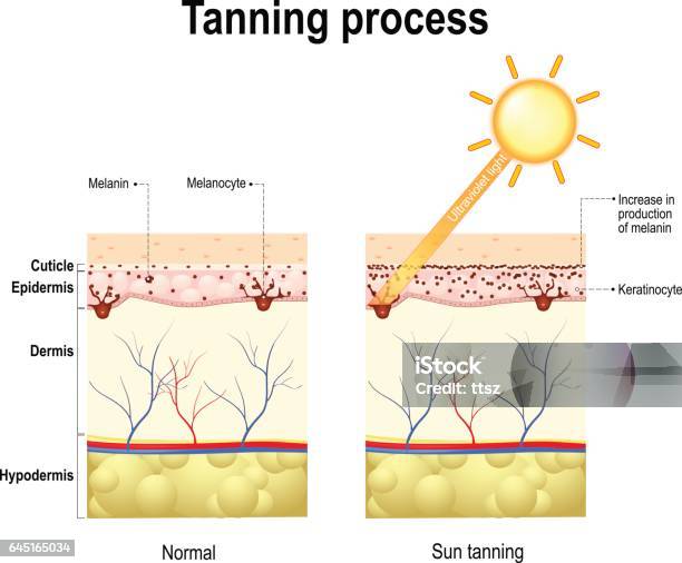 Tanning Process Skin Human Anatomy Stock Illustration - Download Image Now - Skin, Sunburned, Melanin
