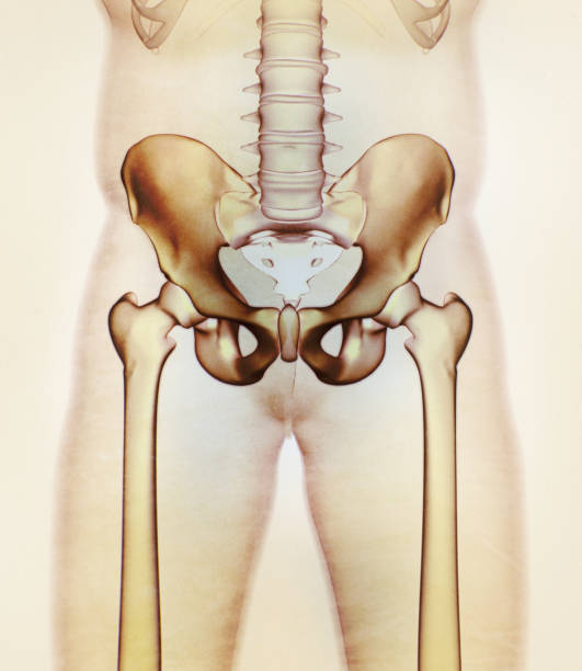 istock Ilium bone, hip bone pelvis. Human anatomy, skeletal structure xray. 645249164