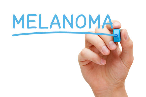istock Melanoma Handwritten With Blue Marker 645284650