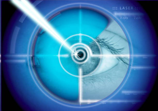 eye laser correction eye laser correction german iris stock pictures, royalty-free photos & images