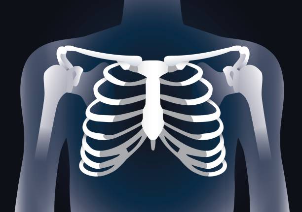 人間肋骨 x 線イメージ コンセプト。 - pain rib cage x ray image chest点のイラスト素材／クリップアート素材／マンガ素材／アイコン素材