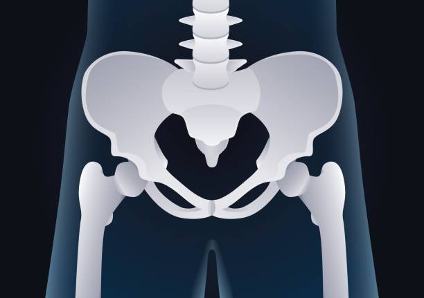 menschlichebeckenknochen im röntgenkonzept. - pelvic bone stock-grafiken, -clipart, -cartoons und -symbole
