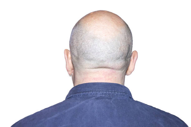 istock Back of man with bald head 645722992