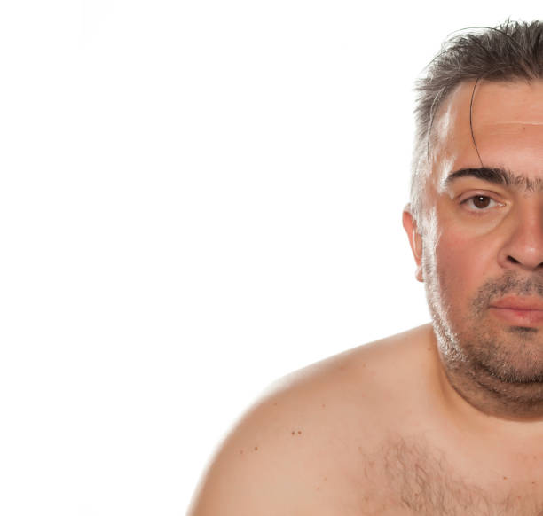 istock Half portrait of a serious obese man 645980940