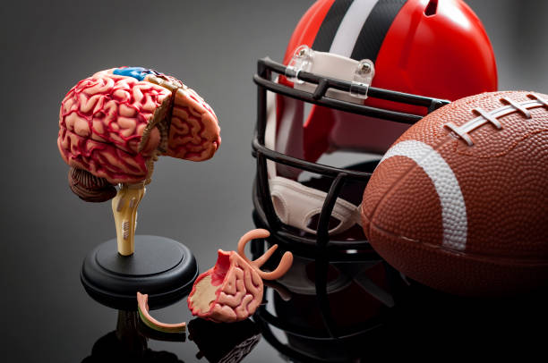 Brain damage and sports injury concept Brain damage and sports injury concept with damaged brain model, american football helmet and a ball, illustrating CTE (Chronic traumatic encephalopathy) a syndrome caused by repeated concussion concussion stock pictures, royalty-free photos & images
