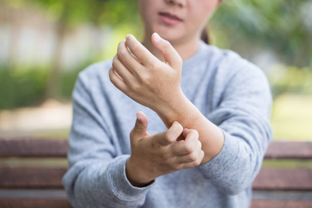 istock Woman scratching her skin 646374164