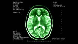 Green Top View Mri Brain Scan Display Loopable Animation Stock Video -  Download Video Clip Now - iStock