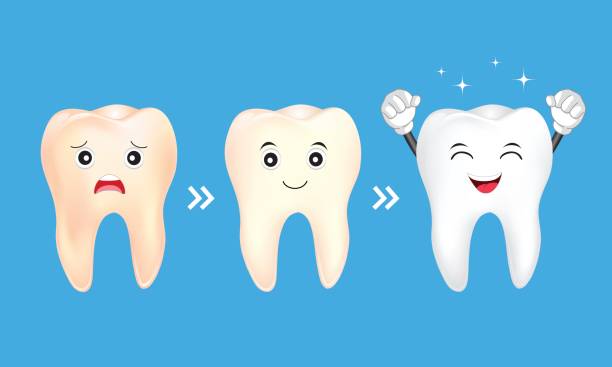 illustrazioni stock, clip art, cartoni animati e icone di tendenza di sbiancamento del carattere dentale. - sbiancamento dentale