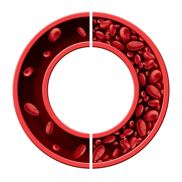 Anemia Anaemia Concept Diagram Anemia and anaemia medical diagram concept as normal and abnormal blood cell count and human circulation in an artery or vein as a 3D illustration isolated on a white background. anemia stock pictures, royalty-free photos & images