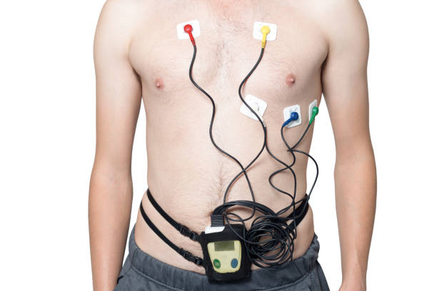 corazón electrocardiograma o monitoreo holter para los jóvenes paciente utilizando - pulse trace electrode human heart holter fotografías e imágenes de stock