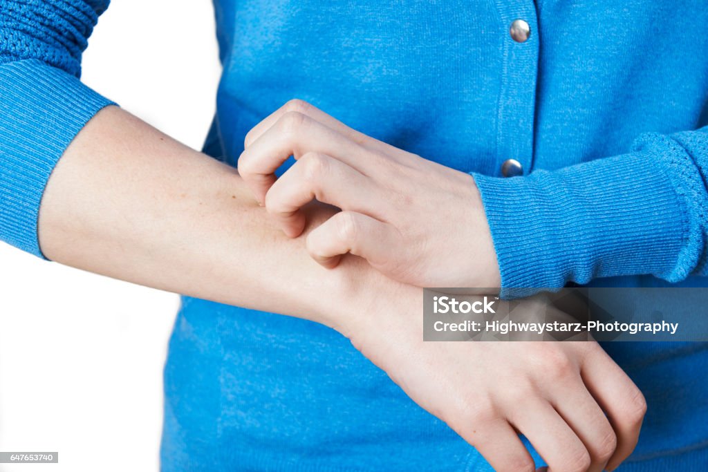 Close Up Of Woman Scratching Arm Close Up Of Woman Scratching Armwomanw Shingles Stock Photo
