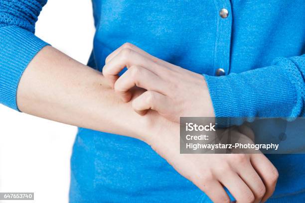 Close Up Of Woman Scratching Arm Stock Photo - Download Image Now - Shingles, Psoriasis, Illness