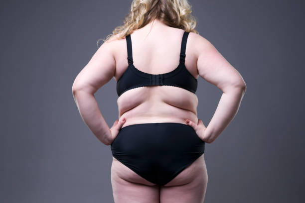 istock Overweight female back, fat woman with cellulitis on buttocks 647695876