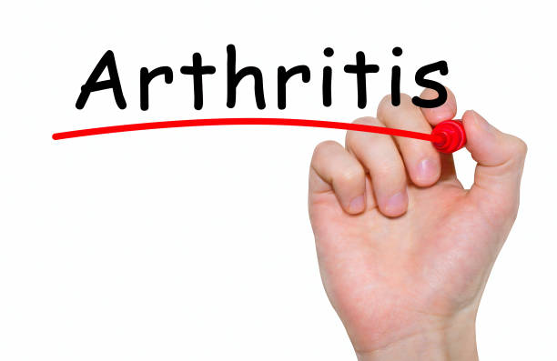 istock Hand writing inscription Arthritis with marker, concept 647717874