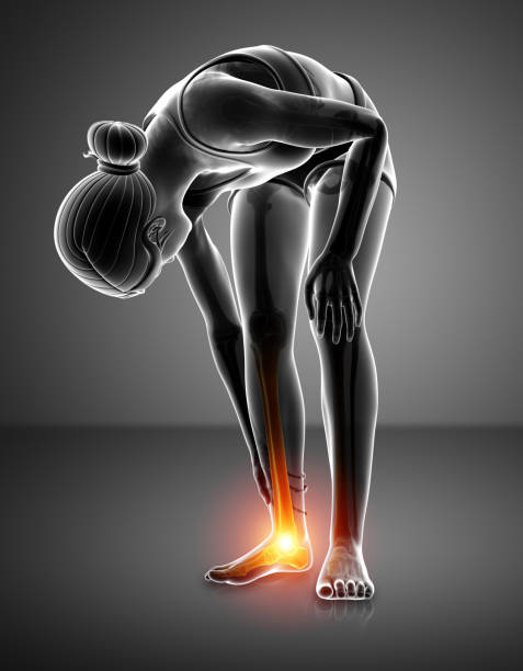 istock Female foot with ankle pain 648092332