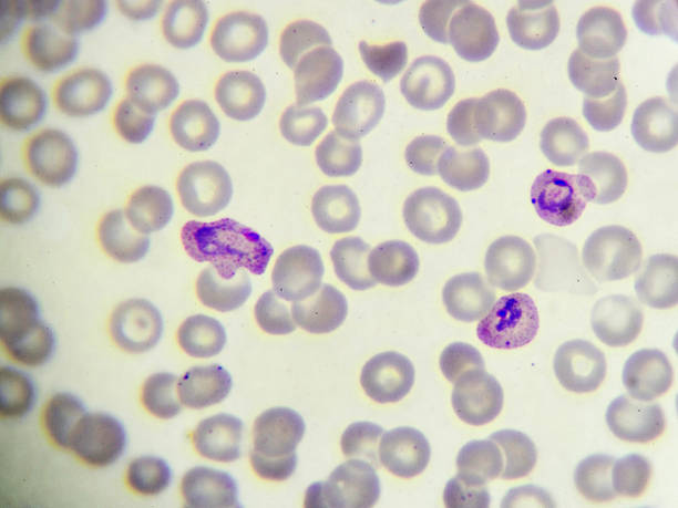 Malaria parasite Malaria parasite in blood film, analyze by microscope malaria blood sample stock pictures, royalty-free photos & images