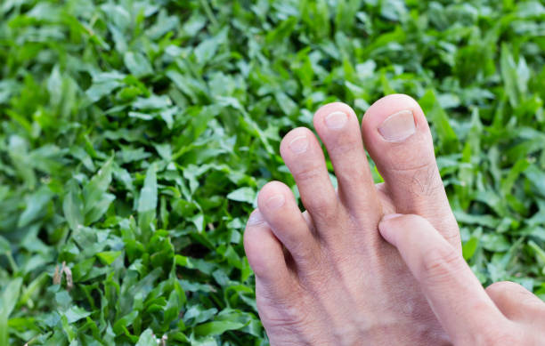 démangeaisons pieds sur fond d’herbe verte - podiatry human foot grass barefoot photos et images de collection