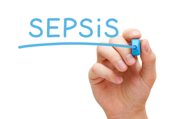 Sepsis Handwritten With Blue Marker Hand writing Sepsis with blue marker on transparent glass board. bacterial mat photos stock pictures, royalty-free photos & images