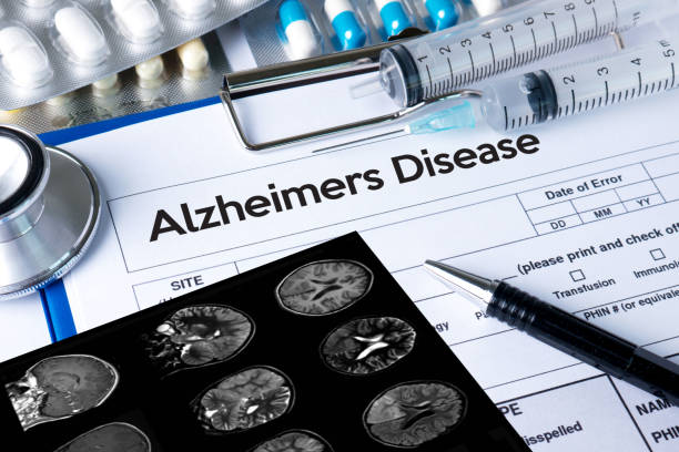 concepto de la enfermedad de alzheimers, enfermedades degenerativas del cerebro parkinson - alzheimer fotografías e imágenes de stock