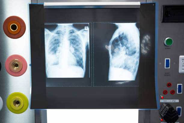 Close-up of x-ray on lightbox Close-up of x-ray on lightbox in hospital Chiral Separation Chromatography Columns stock pictures, royalty-free photos & images