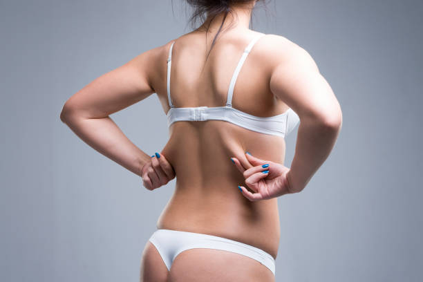 Woman holding fold of skin, cellulite on female body Woman holding fold of skin, cellulite on female body, gray background, studio shot chubby thighs stock pictures, royalty-free photos & images