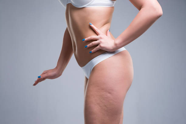 Woman in white underwear, cellulite on female body stock photo