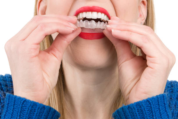 istock Woman Inserting Dental Aligners 649355394