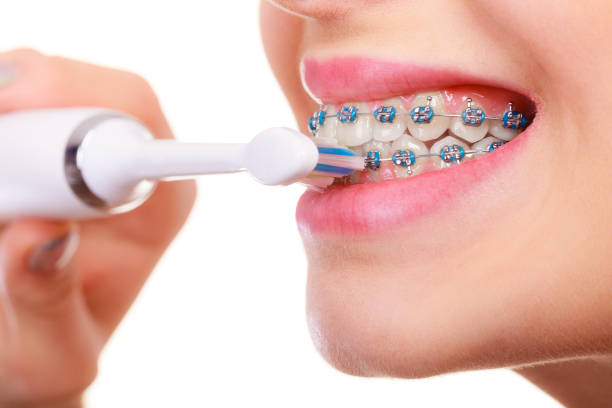 donna che lava i denti con bretelle usando il pennello - healthy lifestyle human teeth adult brushing foto e immagini stock