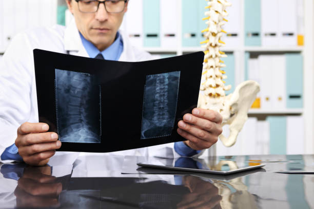 radiologe arzt prüfen, xray, gesundheitswesen, medizin und radiologie-konzept - vertebral body stock-fotos und bilder