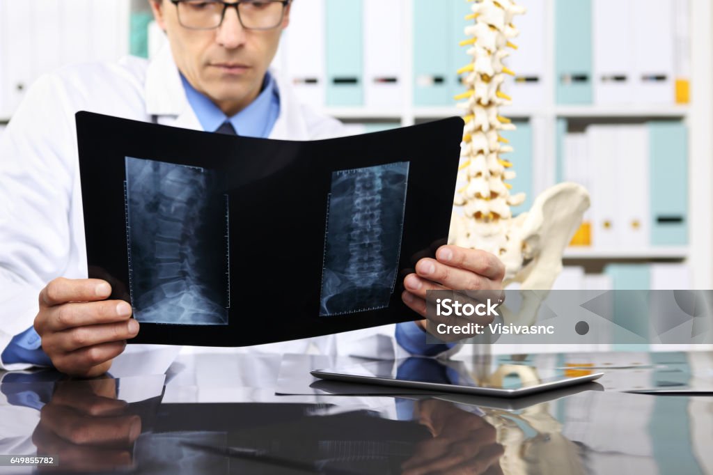 Medico radiologo che controlla il concetto di radiografia, assistenza sanitaria, medicina e radiologia - Foto stock royalty-free di Spina dorsale - Parte del corpo