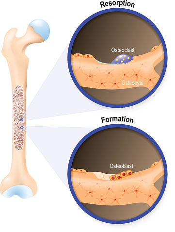 Osteoblast and osteoclast. The bone remodeling process. In a healthy body, osteoclasts and osteoblasts work together to maintain the balance between bone loss and bone formation.