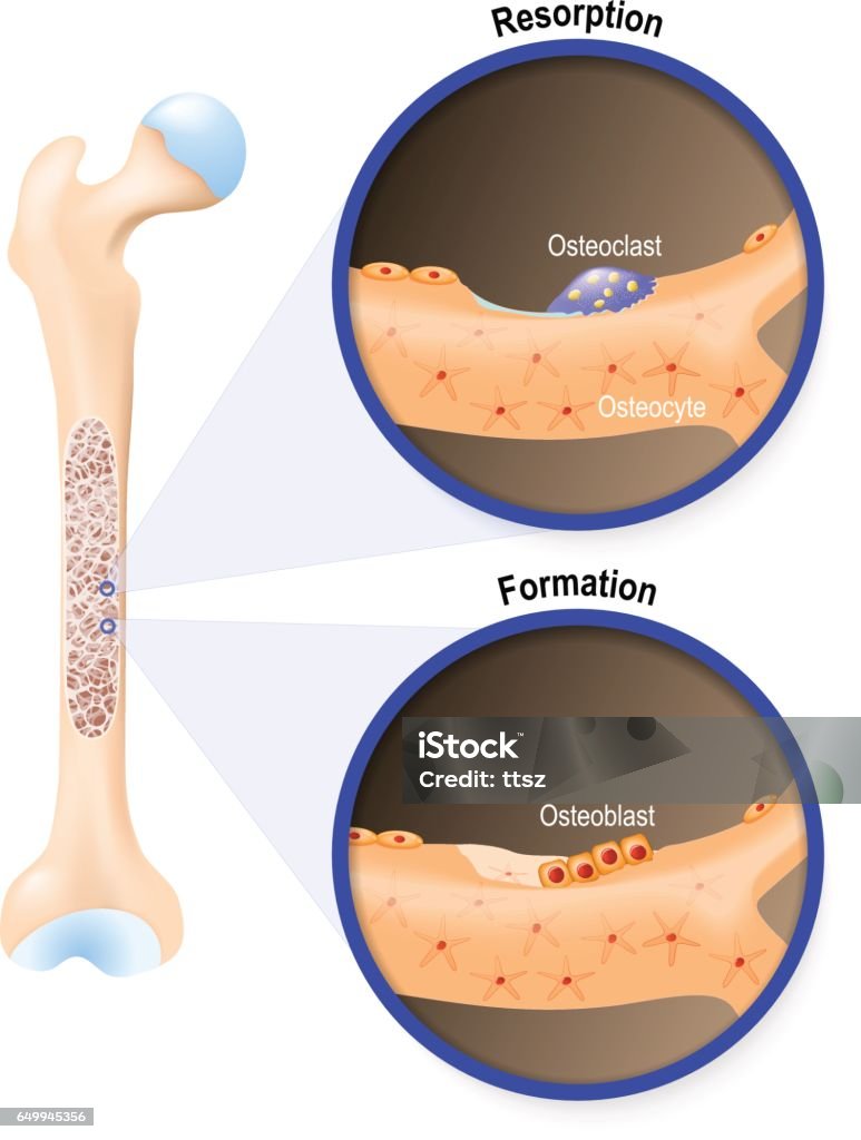 Osteoblast And Osteoclast Stock Illustration - Download Image Now - Bone,  Osteoclast, Osteoblast - iStock