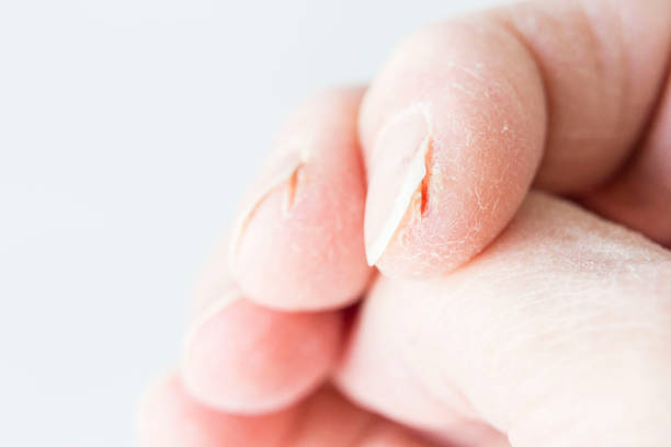 Swollen hands left hand