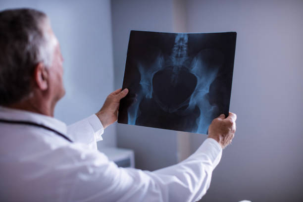 istock Male doctor examining x-ray report 650130250