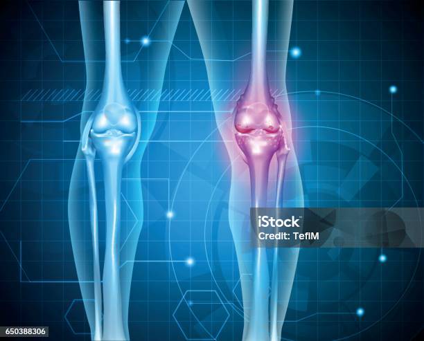 Knee Pain Abstract Background Stock Illustration - Download Image Now - Abstract, Anatomy, Arthritis