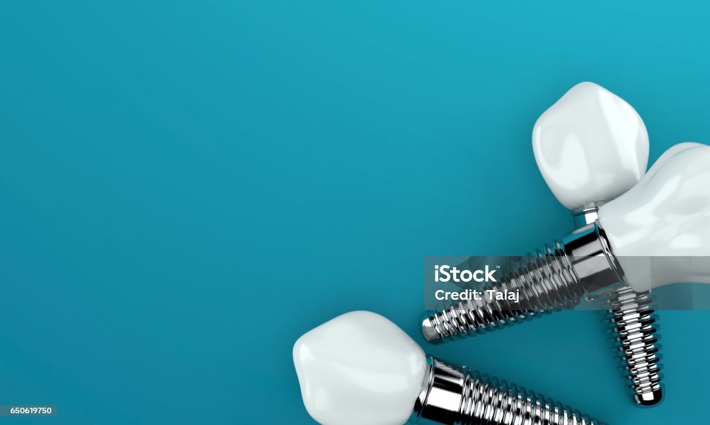 Zahnimplantate auf blauem Hintergrund - Lizenzfrei Zahnimplantat Stock-Foto