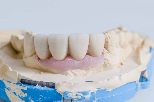 istock Dental technician working in a metal ceramic crowns 650817426