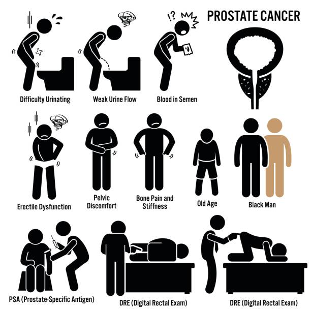 Prostate Cancer Symptoms Causes Risk Factors Diagnosis Stick Figure Pictogram Icons Set of illustrations for prostate cancer disease which include the symptoms, causes, risk factors, and the diagnosis for the illness. dre stock illustrations