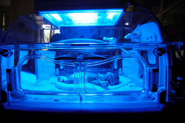 bébé nouveau-né ayant un traitement pour une jaunisse sous lumière ultraviolette dans l’incubateur. - yellowing photos et images de collection