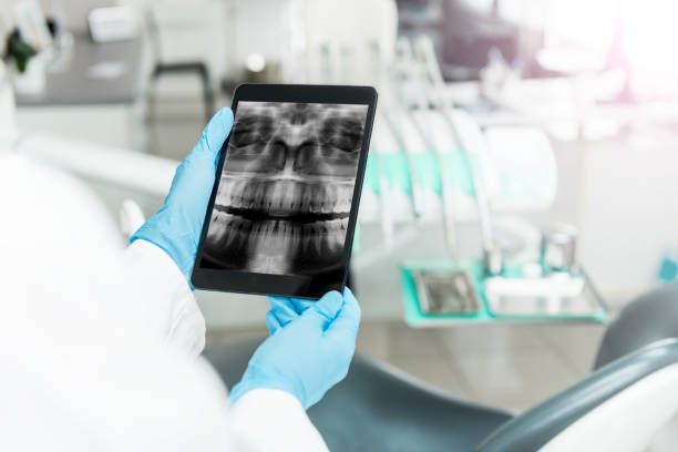 タブレット上の人間の歯の x 線 - 歯 写真 ストックフォトと画像