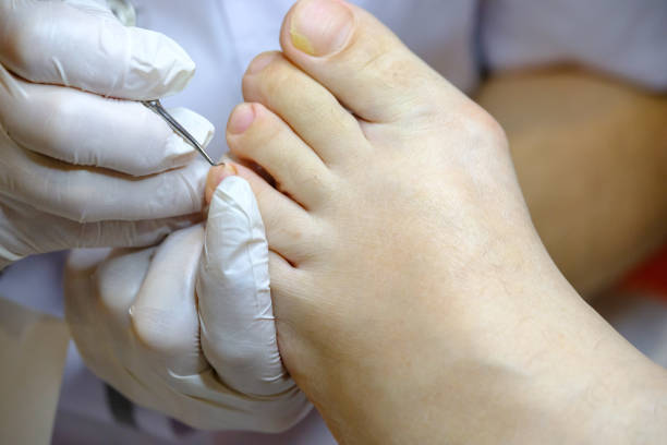 istock Pedicure specialist works with the patient 651691148