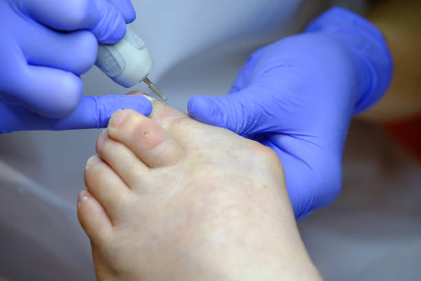 istock Pedicure specialist works with the patient 651693702