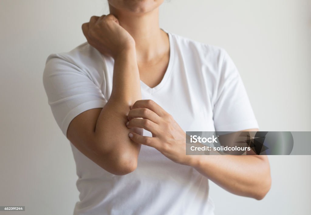 Itch Woman scratch the itch with hand. Scratching Stock Photo