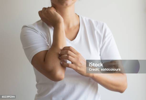 Itch Stock Photo - Download Image Now - Scratching, Eczema, Women