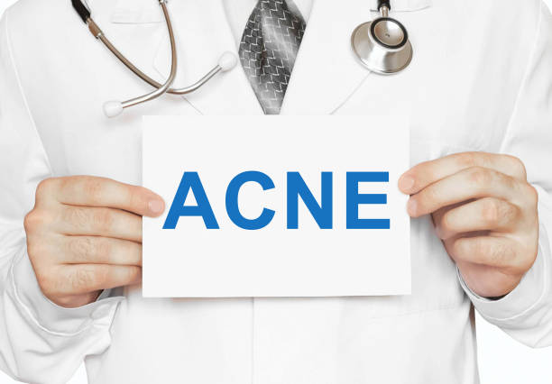 istock Doctor holding a card with ACNE, medical concept 652526320