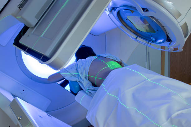 Woman Receiving Radiation Therapy/ Radiotherapy Treatments for Thoracic Cancer stock photo