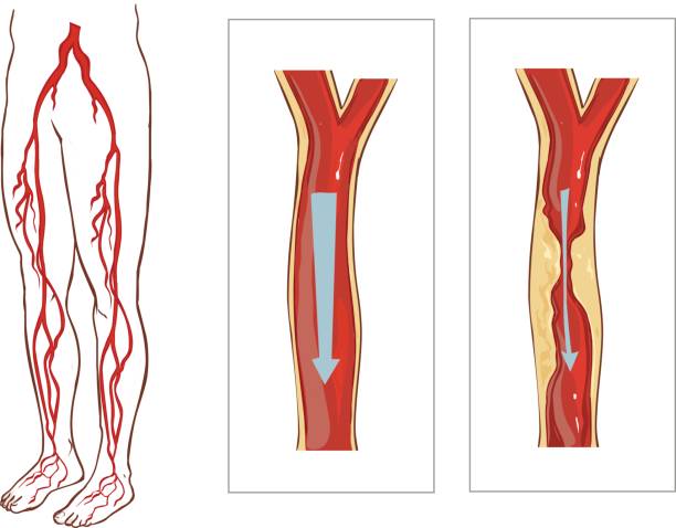 Vector illustration of aVascular System Legs. vector art illustration