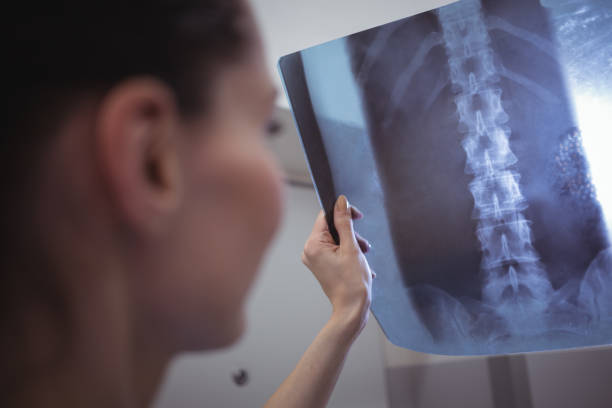istock Female nurse examining x-ray report 653241764