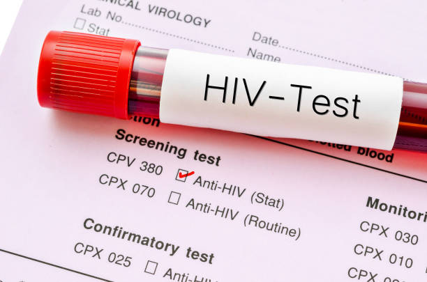 Sample blood collection tube with HIV test label stock photo